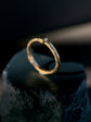 Talus ring