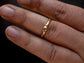 Talus ring